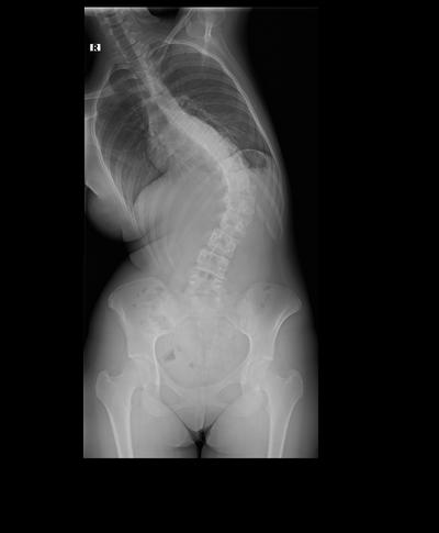 Slide 17