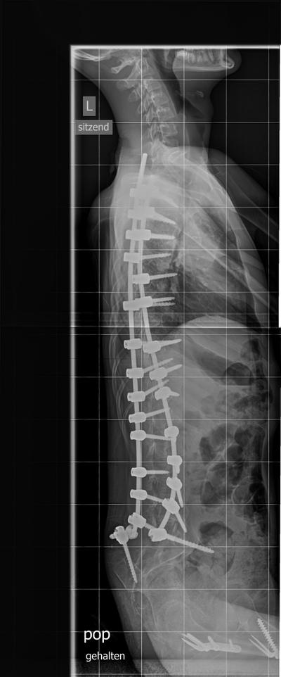 Slide 3