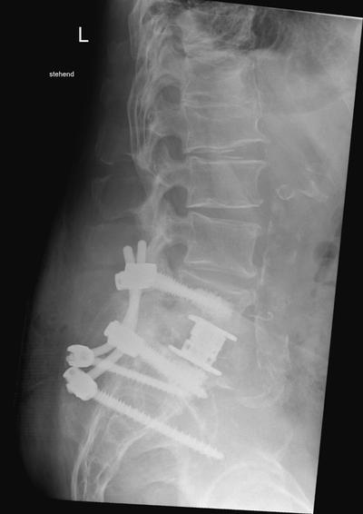 Slide 2